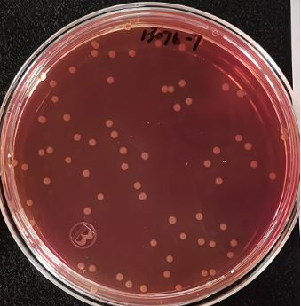 VRBA內(nèi)的紅色小菌落，有可能是沙門氏菌？