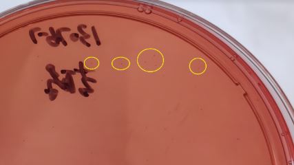 VRBA內(nèi)的紅色小菌落，有可能是沙門氏菌？