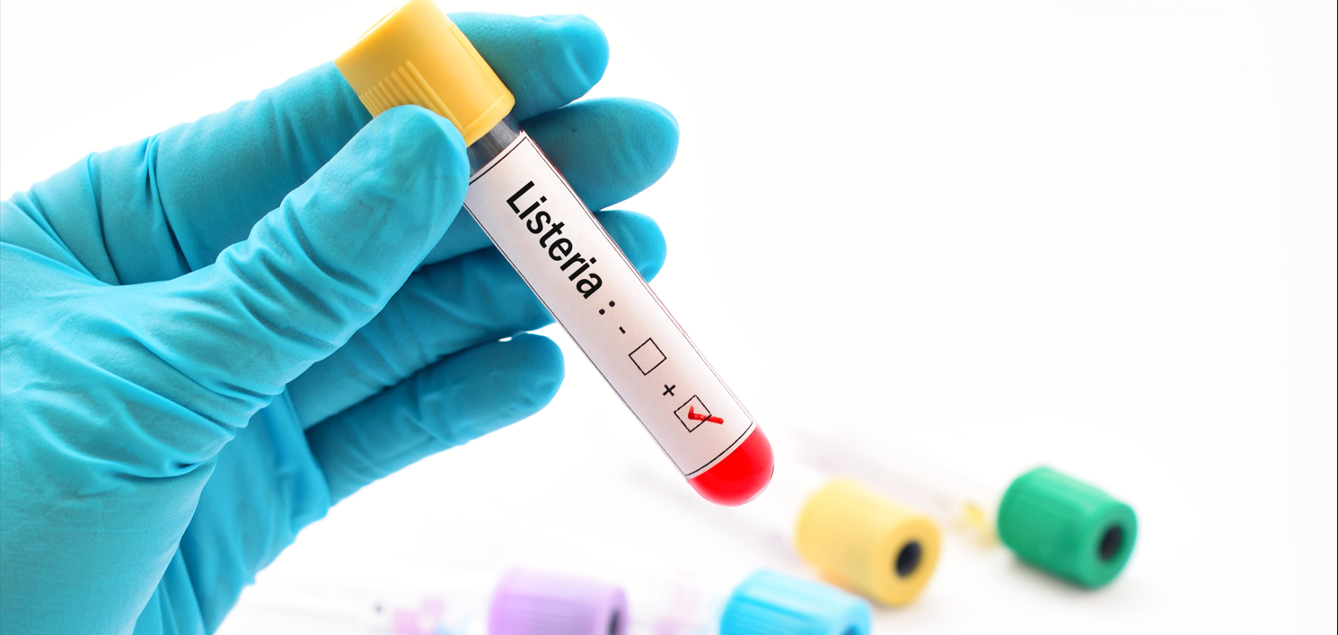 GB4789.30-2025單核細胞增生李斯特氏菌標準變化